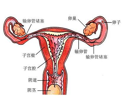输卵管不通有什么症状？