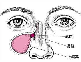 鼻窦炎的症状结构